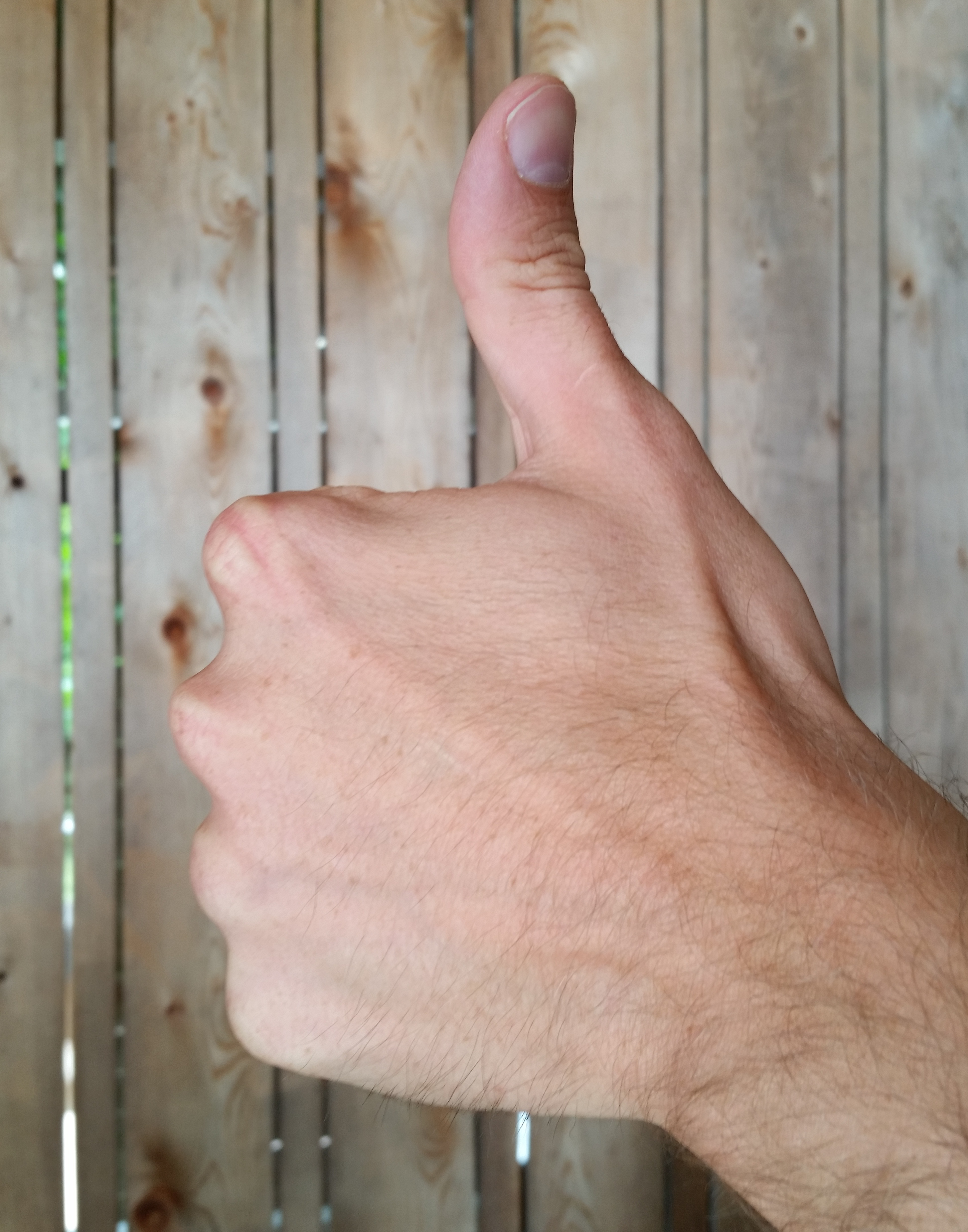 ThumbsUp